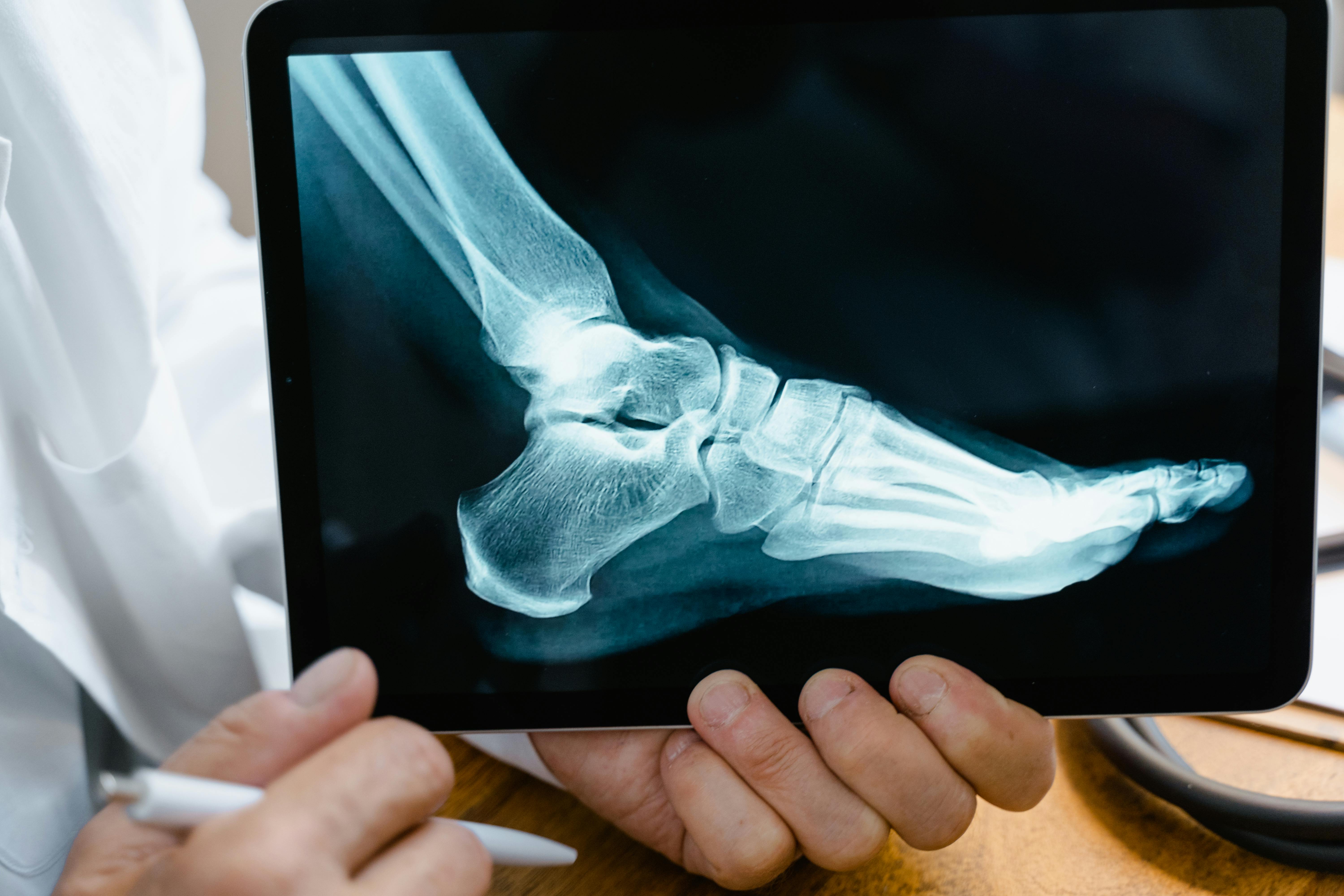 Röntgenbild der Fuss Knochen für die Orthopädie